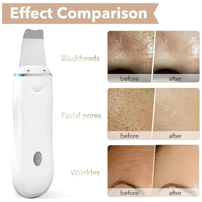 Advanced Facial Cleanser - Pore Minimizer with LED Light Therapy