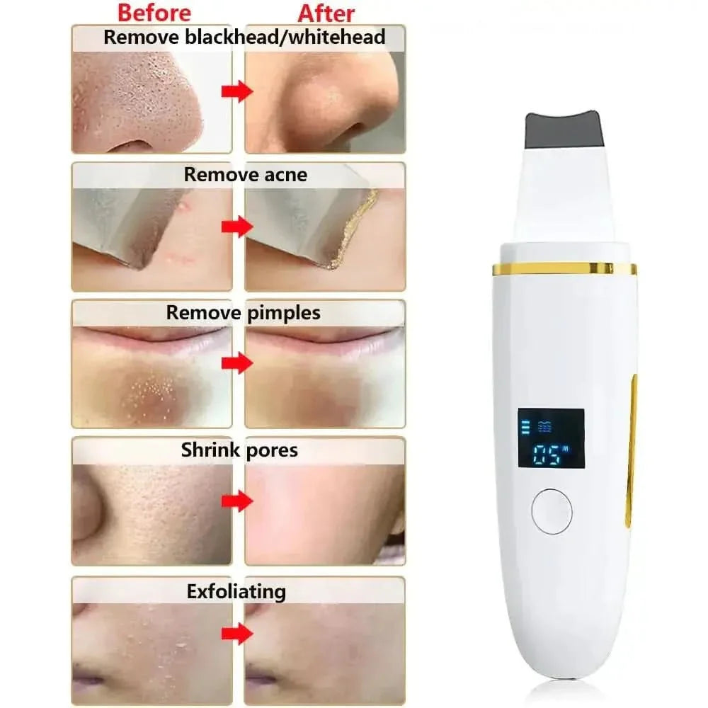 Advanced Facial Cleanser Deep Cleansing Skin Exfoliator