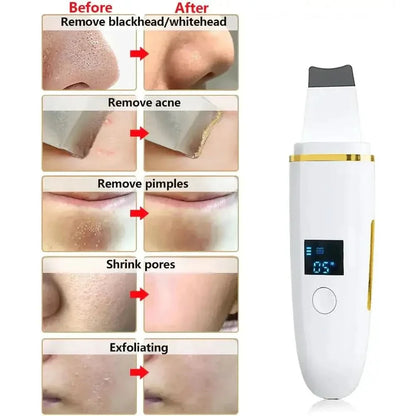 Advanced Facial Cleanser Deep Cleansing Skin Exfoliator