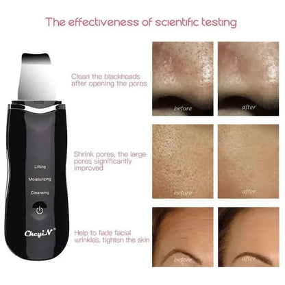 Portable Facial Steamer and Exfoliator Device