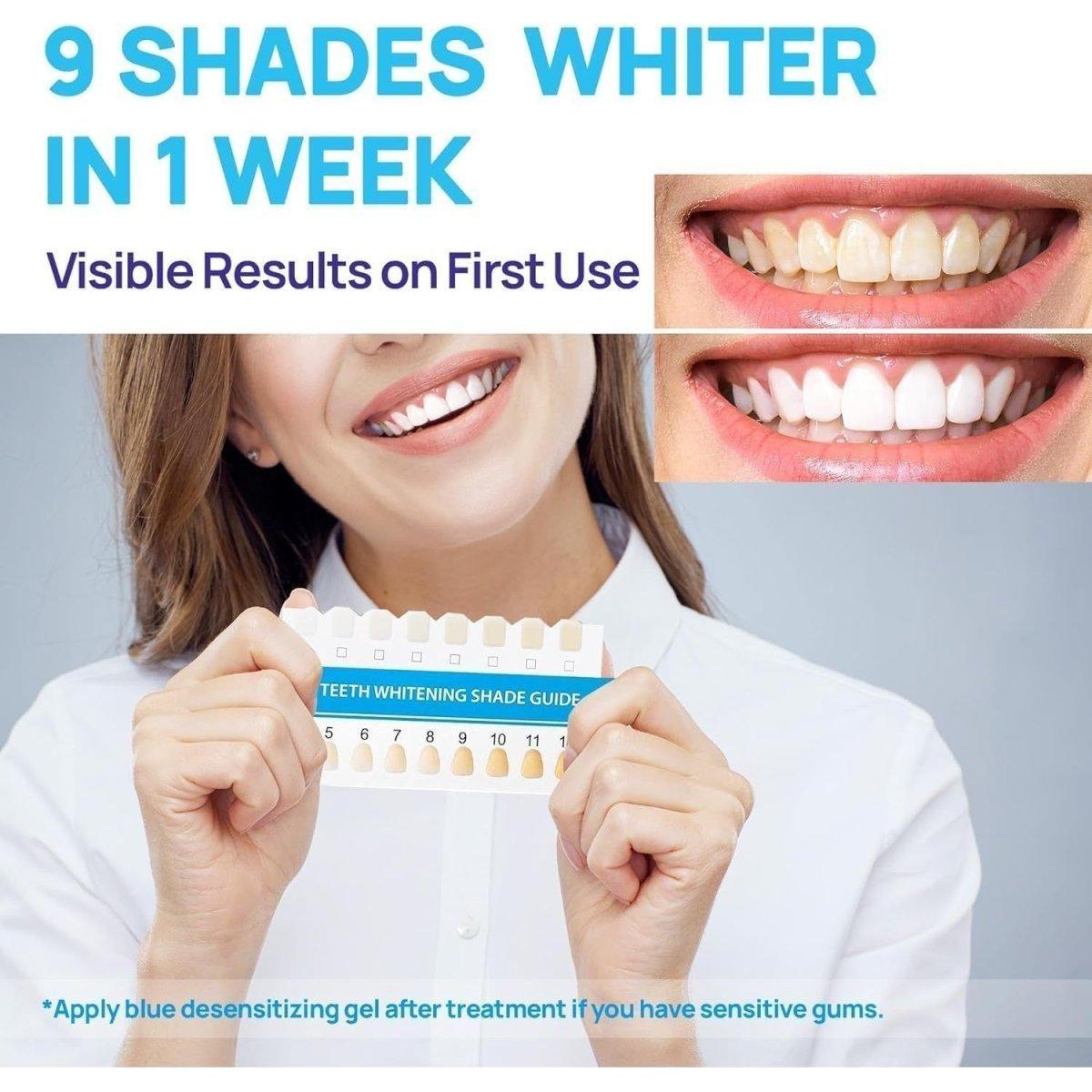 Advanced At Home Teeth Whitening System with LED Light
