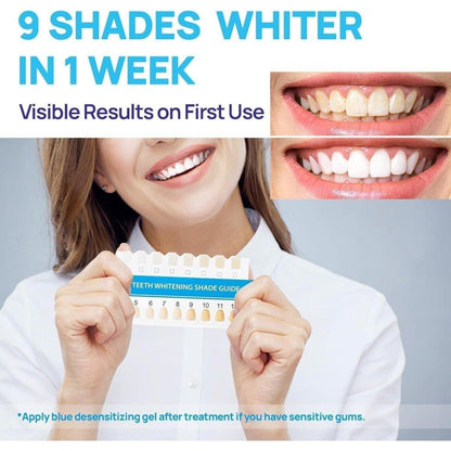 Advanced At Home Teeth Whitening System with LED Light
