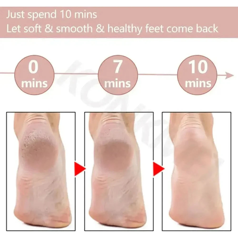 Gentle Foot Scrubber for Soft Feet at Home