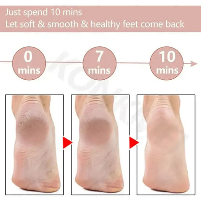 Gentle Foot Scrubber for Soft Feet at Home