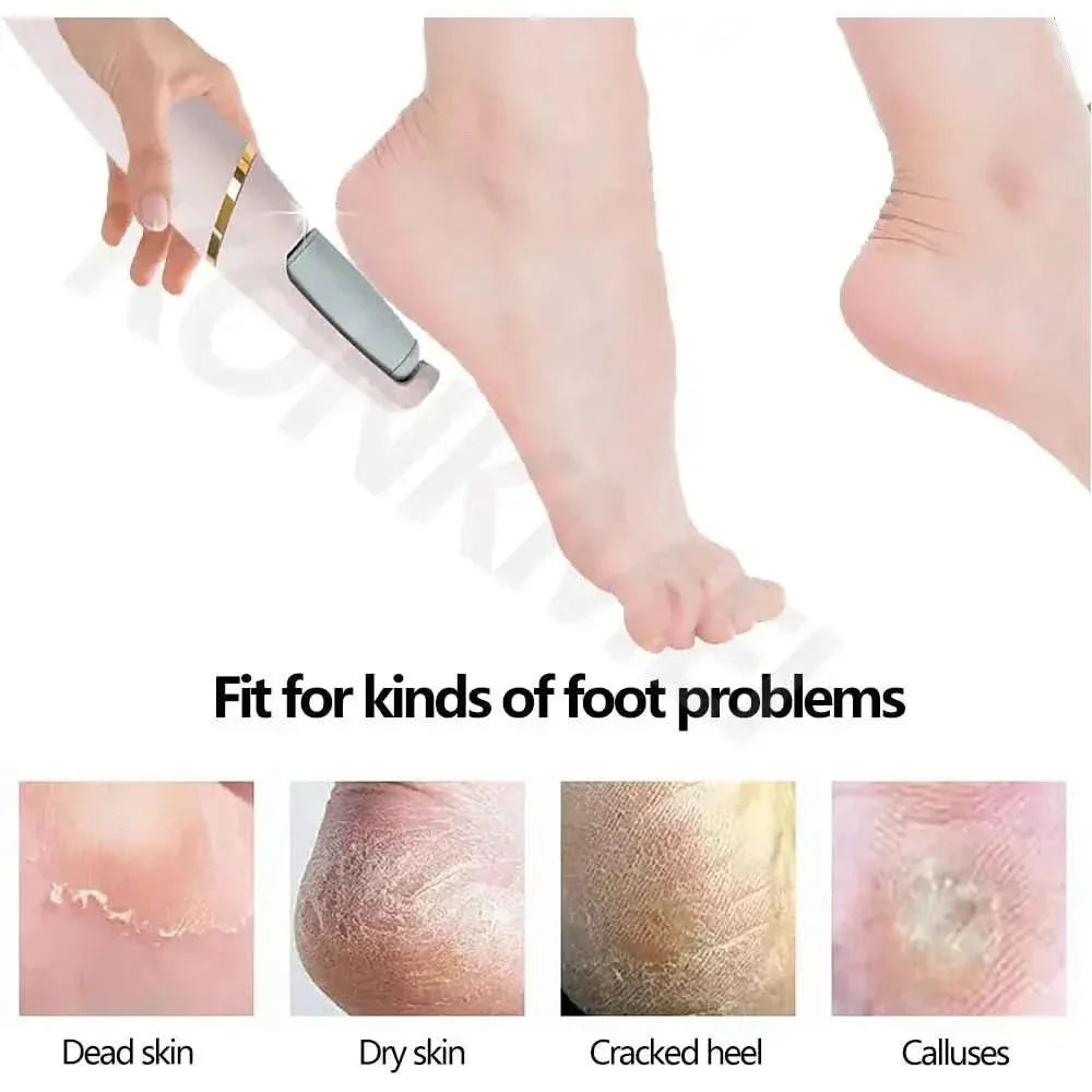 Gentle Foot Scrubber for Soft Feet at Home