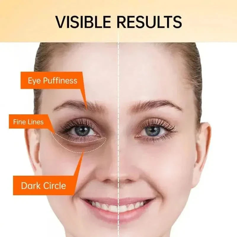 Natural Brightening Eye Cream - Reduces Dark Circles Fast