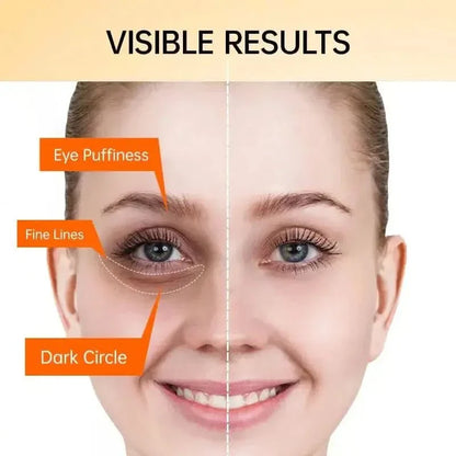 Natural Brightening Eye Cream - Reduces Dark Circles Fast