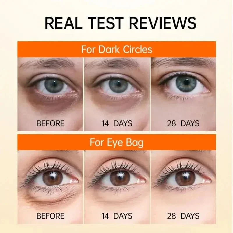 Natural Brightening Eye Cream - Reduces Dark Circles Fast