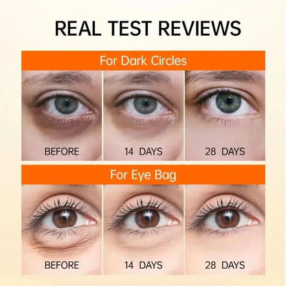 Natural Brightening Eye Cream - Reduces Dark Circles Fast