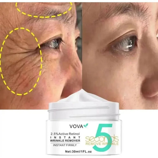 Anti Aging Retinol Moisturizer Cream 30ml - Mycosmeticslondon