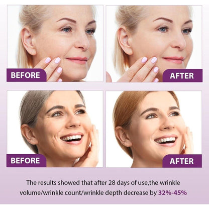 Anti Aging Face Serum Set with Bakuchiol & Retinol