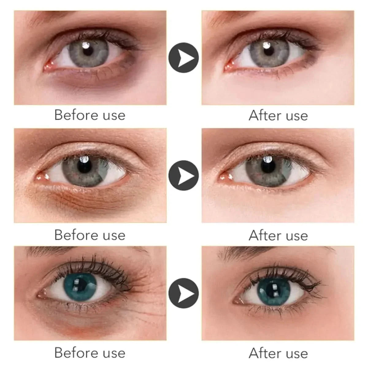 Anti Aging Eye Serum for Younger Looking Eyes 20ml
