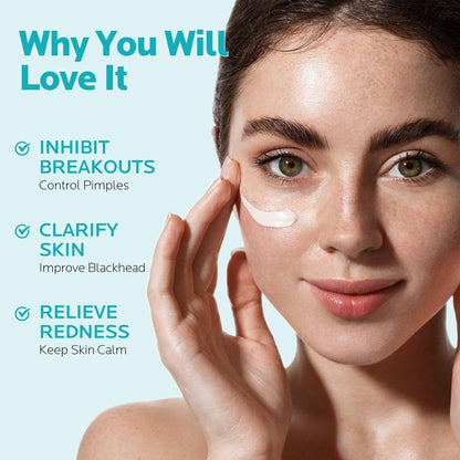 Gentle Azelaic Acid Moisturizing Cream 10% - 30ml