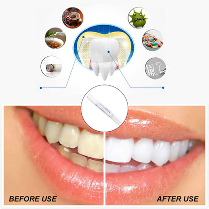 Extreme Instant Whitening Pen - InstaWhite