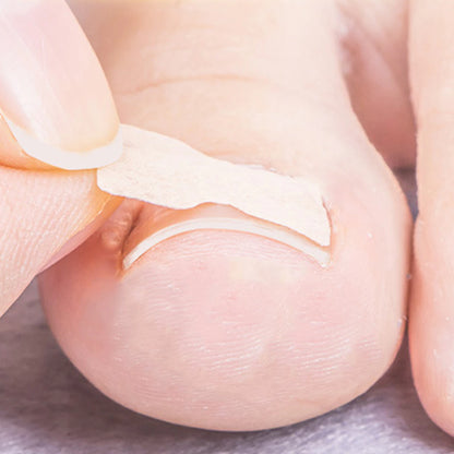 Painless Toenail Patch