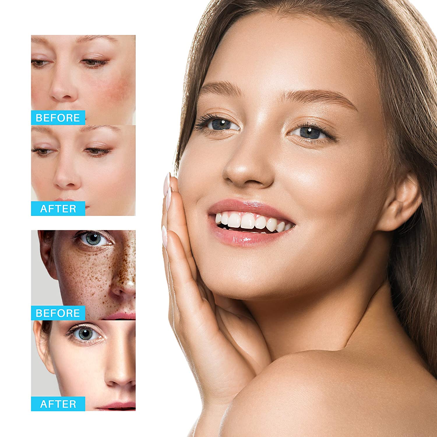 Whitening freckle cream remove dark spot