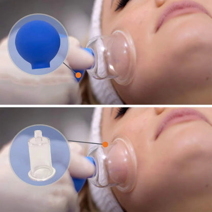 4 Pcs Glass Face Cupping Set