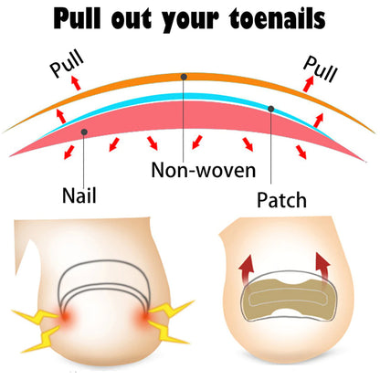 Painless Toenail Patch