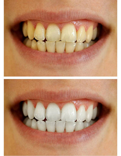 Extreme Instant Whitening Pen - InstaWhite