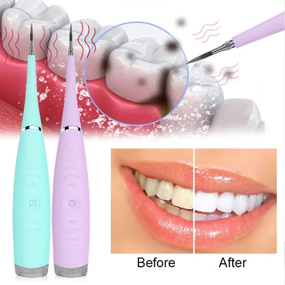 OralCare Ultrasonic Teeth Cleaner