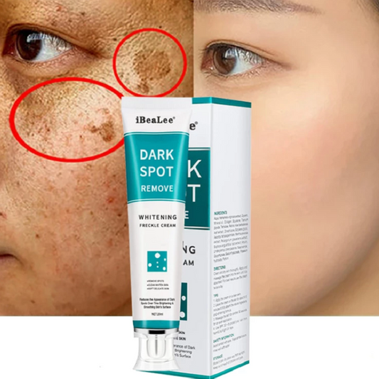 Whitening freckle cream remove dark spot