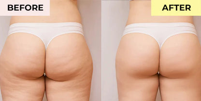 90g Original Beautific Anti Cellulite Firming & Slimming Soap