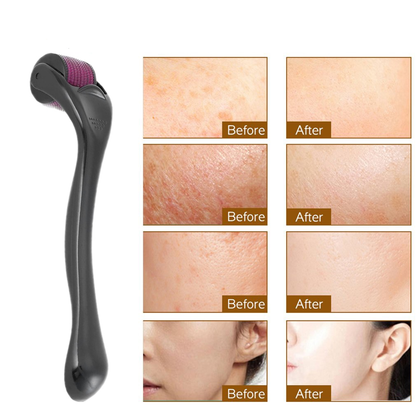 0.25mm Derma Roller for Face and Hair