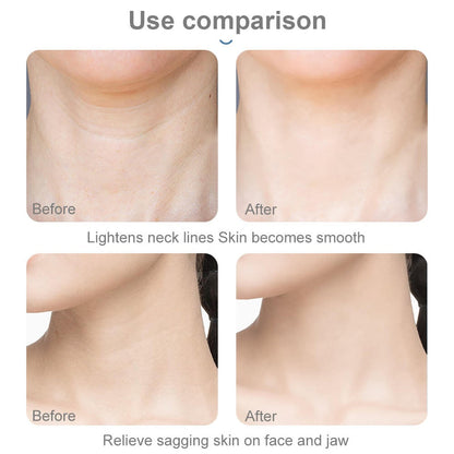 Zero Double Chin - Photon LED Neck Massager For Neck Lifting And Anti Wrinkles