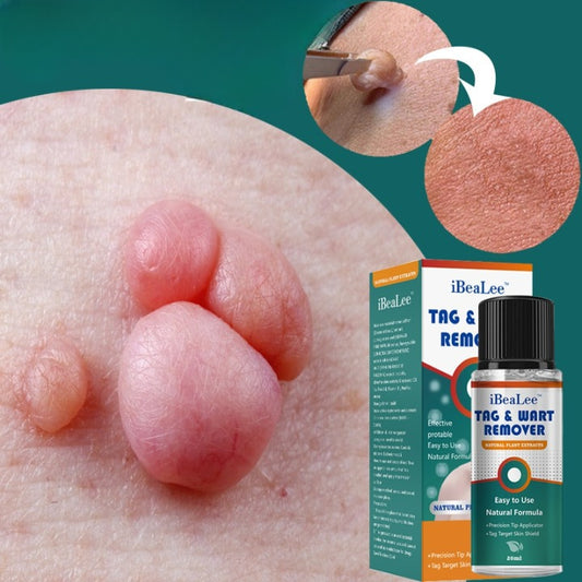 Painless Skin Tag Remover & Wart Removal Oil