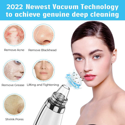 Upgraded Electric Blackhead Remover Extractor Tool