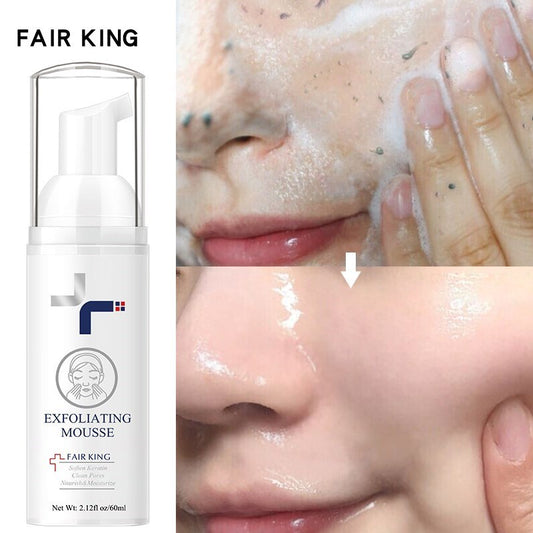 Facial Dead Skin Remover Exfoliating Peeling Gel