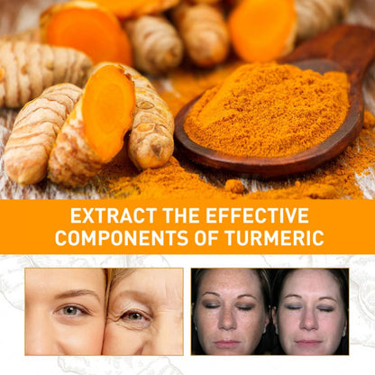 Turmeric Freckle Serum for Age Spots and Dark Spots