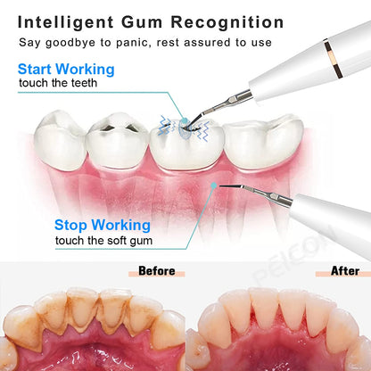 Professional Ultrasonic Tooth Cleaner Tartar and Plaque Removal