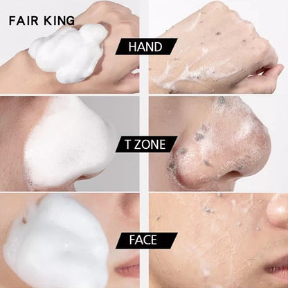 Facial Dead Skin Remover Exfoliating Peeling Gel
