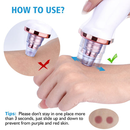 Electric Blackhead Remover Extractor Tool