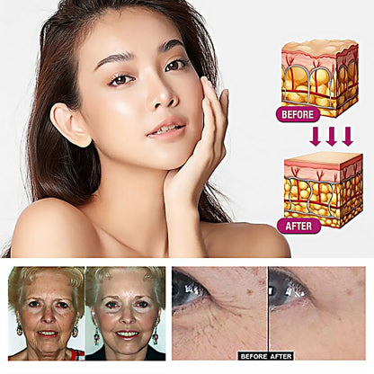 20Pcs Wash Free Korean Collagen Firming Mask
