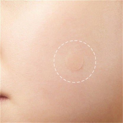 Skin Tag Acne Remover Patch