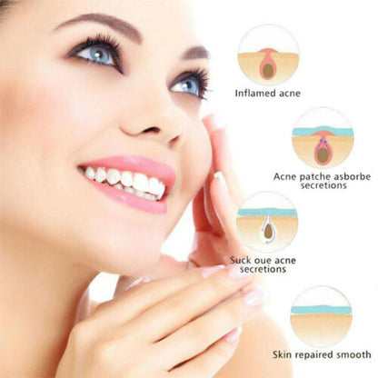 Skin Tag Acne Remover Patch